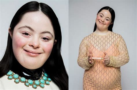 gucci model down syndrome|Gucci modeling.